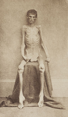 2012-09-11-can-this-be-hell http://commons.wikimedia.org/wiki/File:Andersonvillesurvivor.jpg