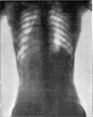 http://commons.wikimedia.org/wiki/File:Corset1908_047Fig25.png