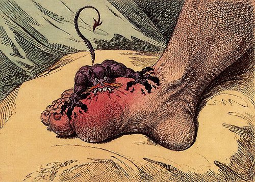 http://commons.wikimedia.org/wiki/File:The_gout_james_gillray.jpg
