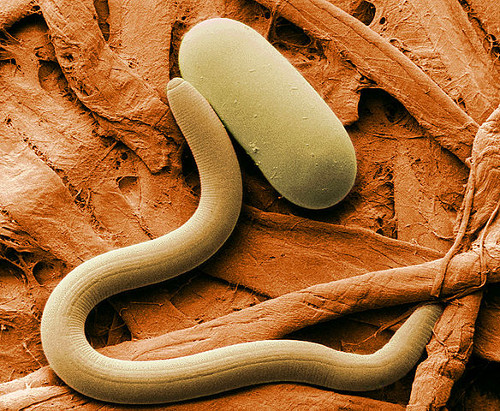 https://commons.wikimedia.org/wiki/File:Soybean_cyst_nematode_and_egg_SEM.jpg