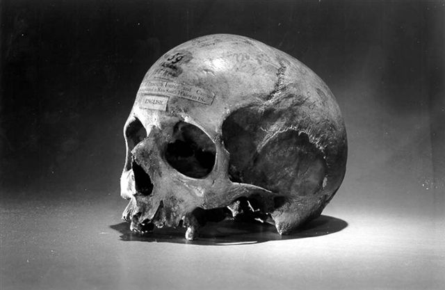 https://commons.wikimedia.org/wiki/File:Skull_of_Alexander_Pearce.jpg